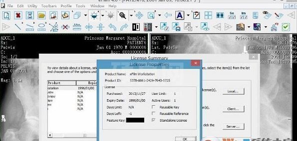 eFilm破解版_eFilm(医学图像处理软件)v4.0 最新中文免费版